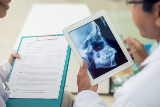 Dentist holding clipboard with paperwork talking to dentist holding tablet showing x rays of jaw