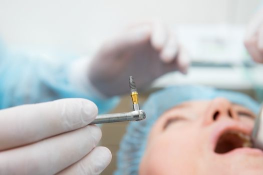 Dentist preparing to place a dental implant in a patient's mouth